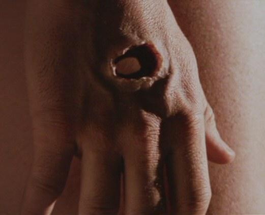 mano risorto